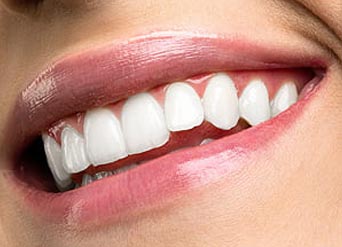 How Does Teeth Whitening in Moreno Valley Work?